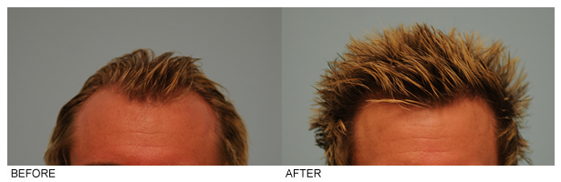 how to regrow damaged natural hair